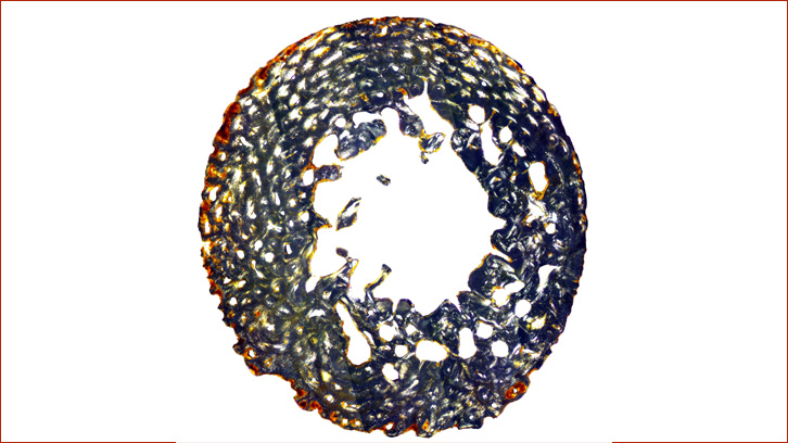 Secció de l'húmer d'individu perinatal sota llum polaritzada