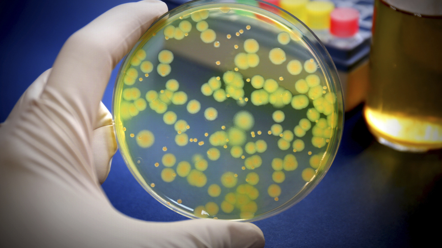 Diferenciació dels bacteris Pseudomonas aeruginosa. iStock-879088822