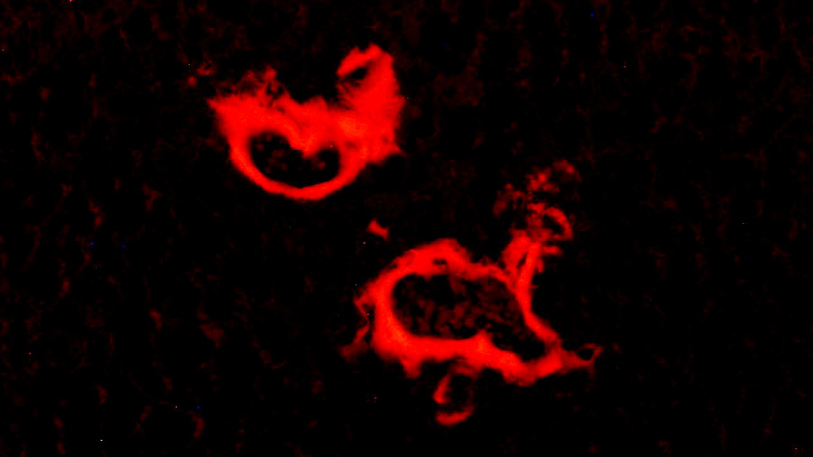 Amiloidosis al parènquima dels vasos sanguinis del fetge en ratolins model de malaltia d'Alzheimer 