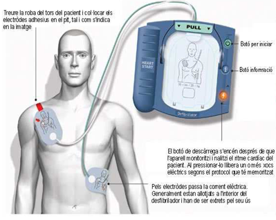 Desfibrilador Philips