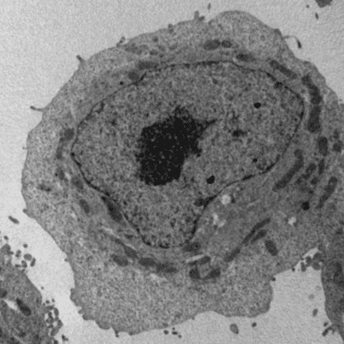 Célula vista por microscopía electrónica de transmisión