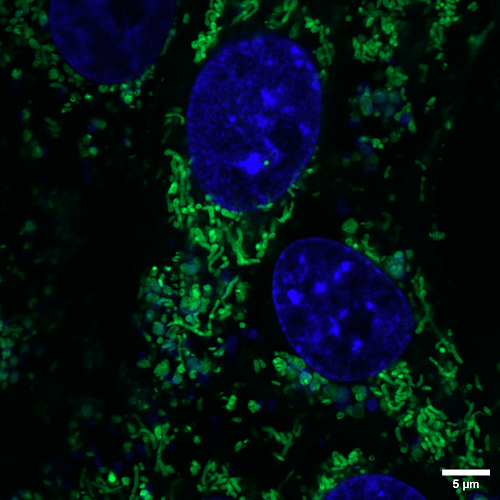 Imagen de alta resolución en la que se pueden observar mitocondrias y un núcleo con gran detalle.