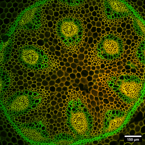 Imagen de epifluorescencia