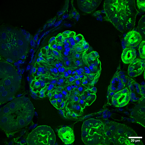 Imagen de fluorescencia