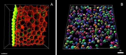 Imágenes renderizadas en 3D para su observación y cuantificación