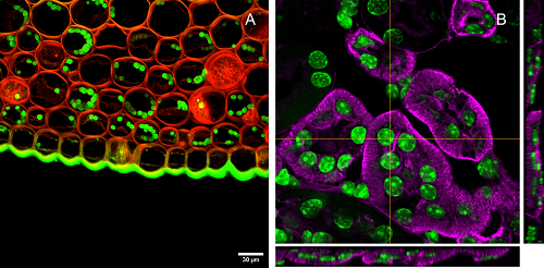 Imágenes tridimensionales de una raíz de Convallaria majalis y una sección de riñón de ratón.